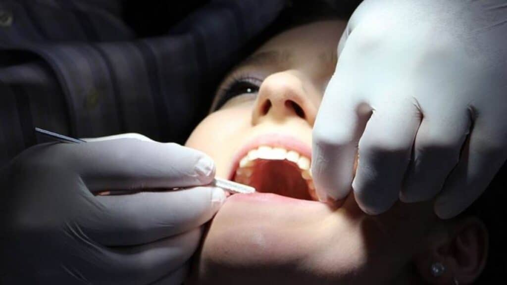 blanqueamiento dental beneficios